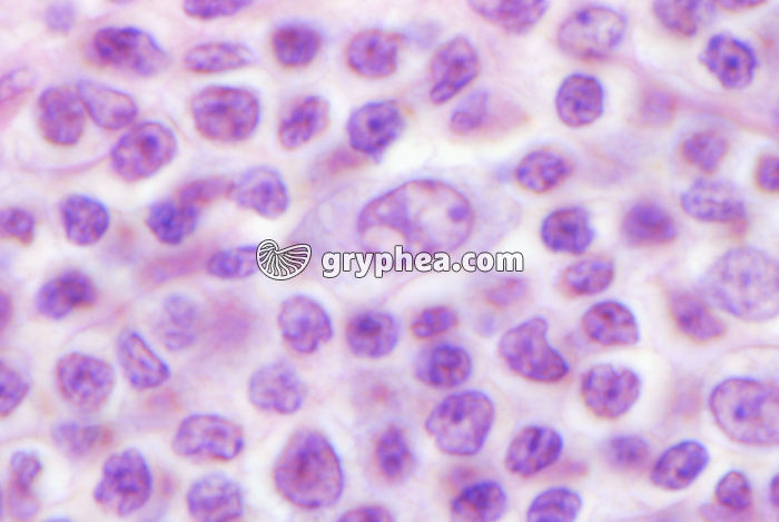 Ganglion lymphatique x800 - gryphea.org